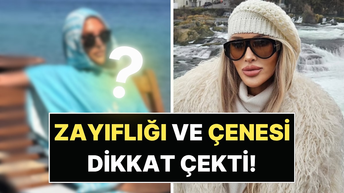 Seren Serengil'in çenesi Photoshop mu, estetik mi?