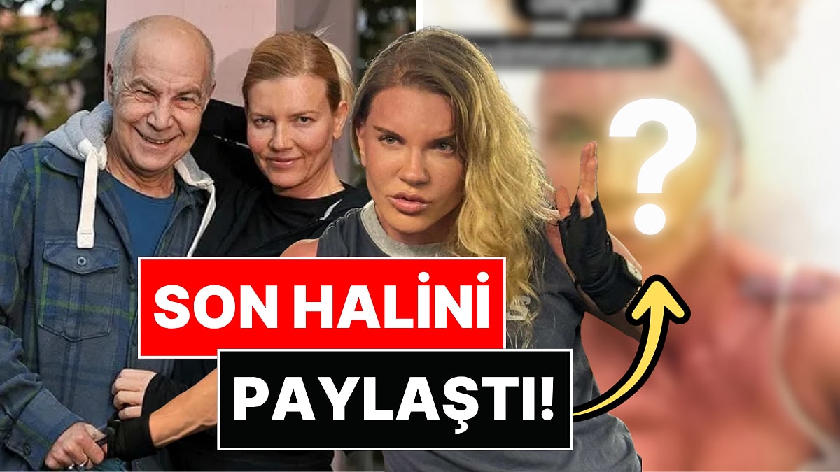 Mazhar Alanson'un eşi Biricik Suden, estetik işlem sonrası son halini paylaştı!