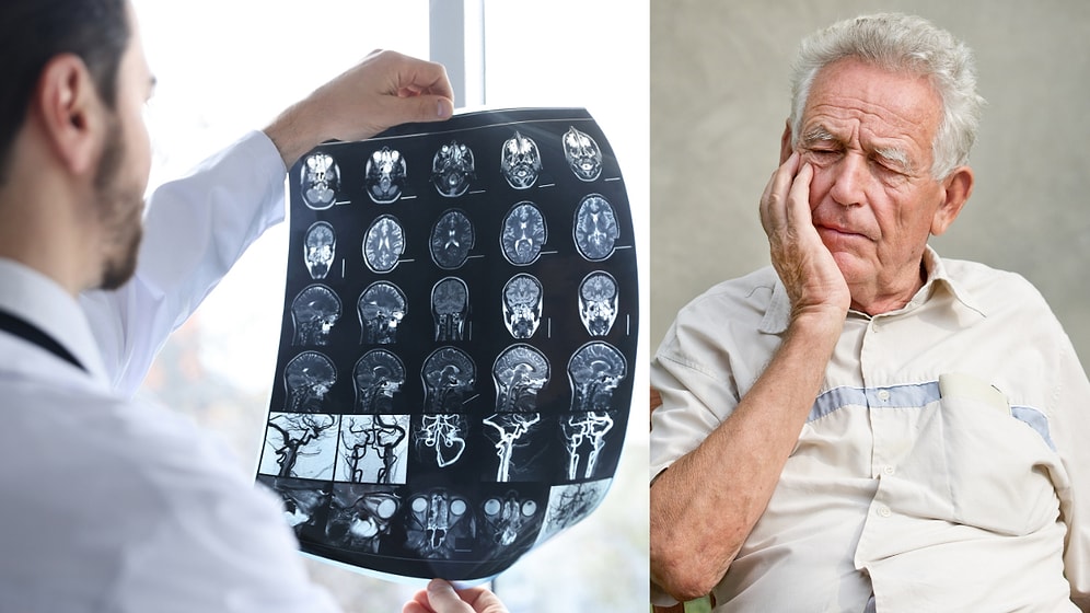 WHO Unveils New Dementia Guidelines: Omega-3 and Vitamin Supplements Excluded for Brain Health