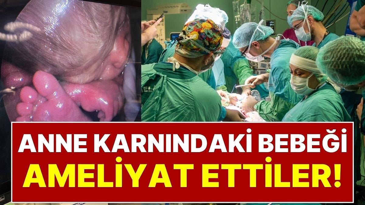 Tıp Dünyasında Çığır Açan Mucize Ankara’da Gerçekleşti: Anne Karnındaki Bebeği Ameliyat Ettiler