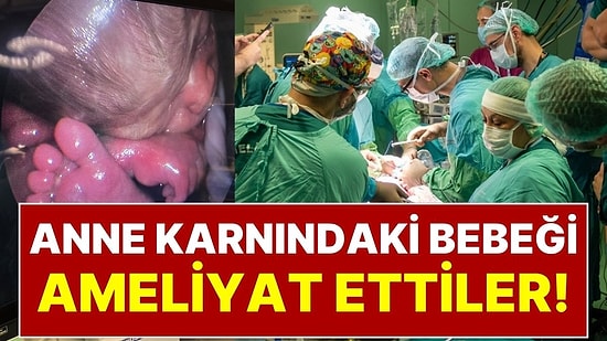 Tıp Dünyasında Çığır Açan Mucize Ankara’da Gerçekleşti: Anne Karnındaki Bebeği Ameliyat Ettiler