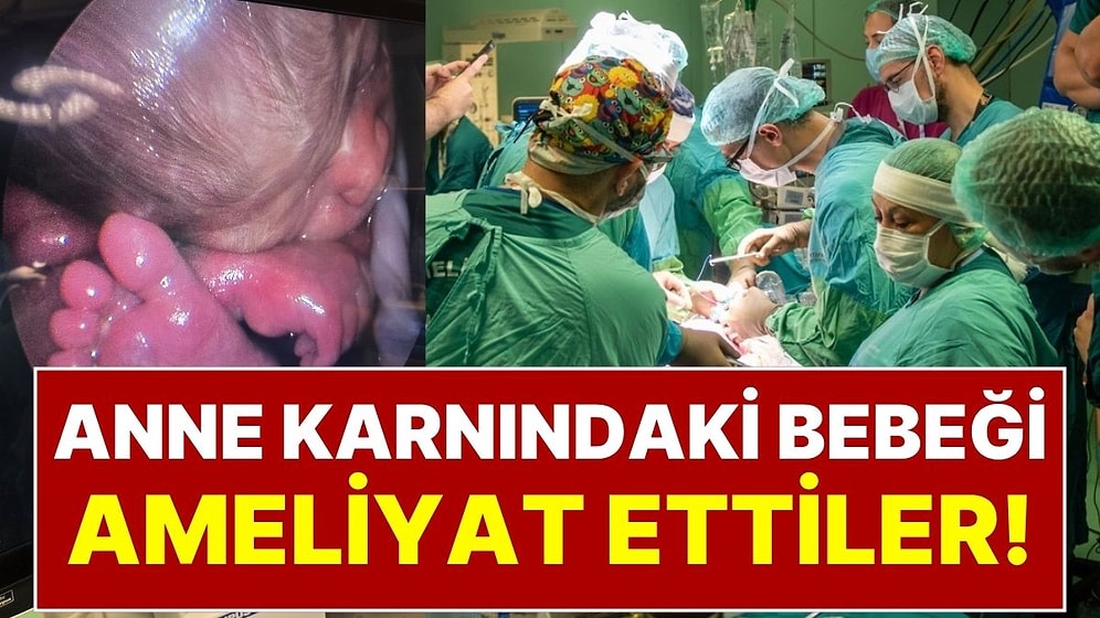 Tıp Dünyasında Çığır Açan Mucize Ankara’da Gerçekleşti: Anne Karnındaki Bebeği Ameliyat Ettiler