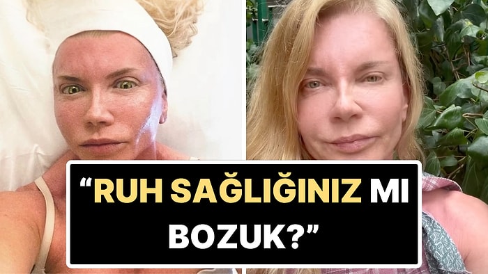 Mazhar Alanson'un Eşi Biricik Suden Estetik Yorumlarına Ateş Püskürdü!