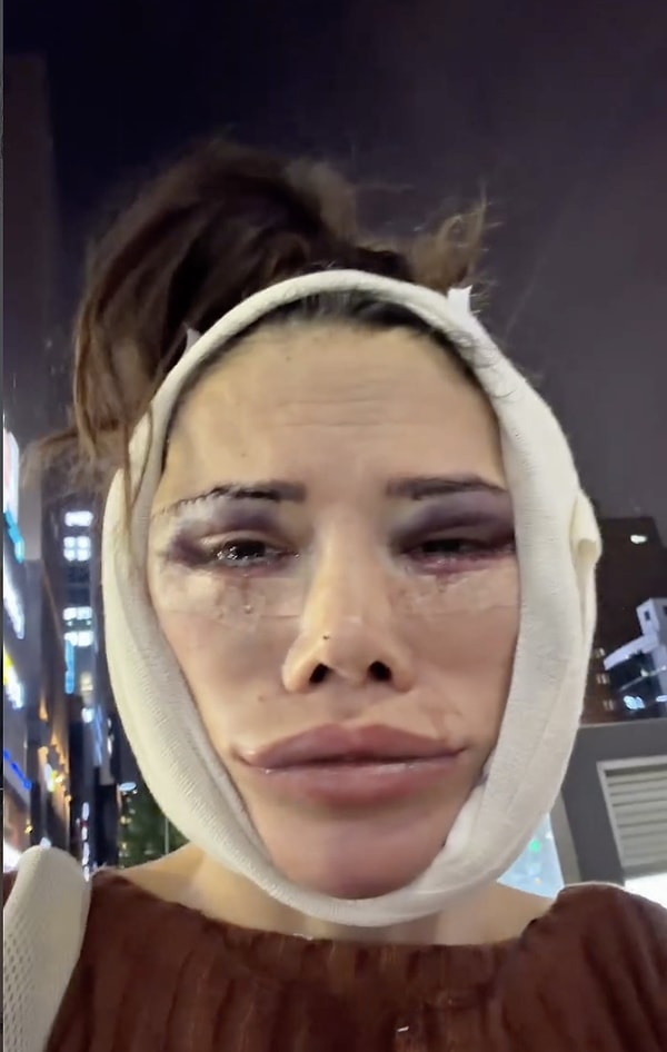One of the most discussed details in Didem Ceran's recent posts was the loss of consciousness she experienced after surgery.