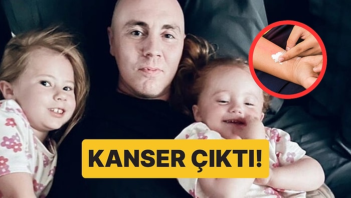 Böcek Isırığı Sandı, Gerçek Aylar Sonra Ortaya Çıktı