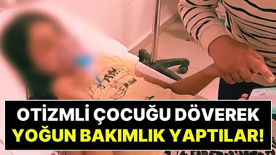 “Mahallemizde İstemiyoruz” Denilerek Komşuları Tarafından Dövülen Otizmli Çocuk Yoğun Bakımda!