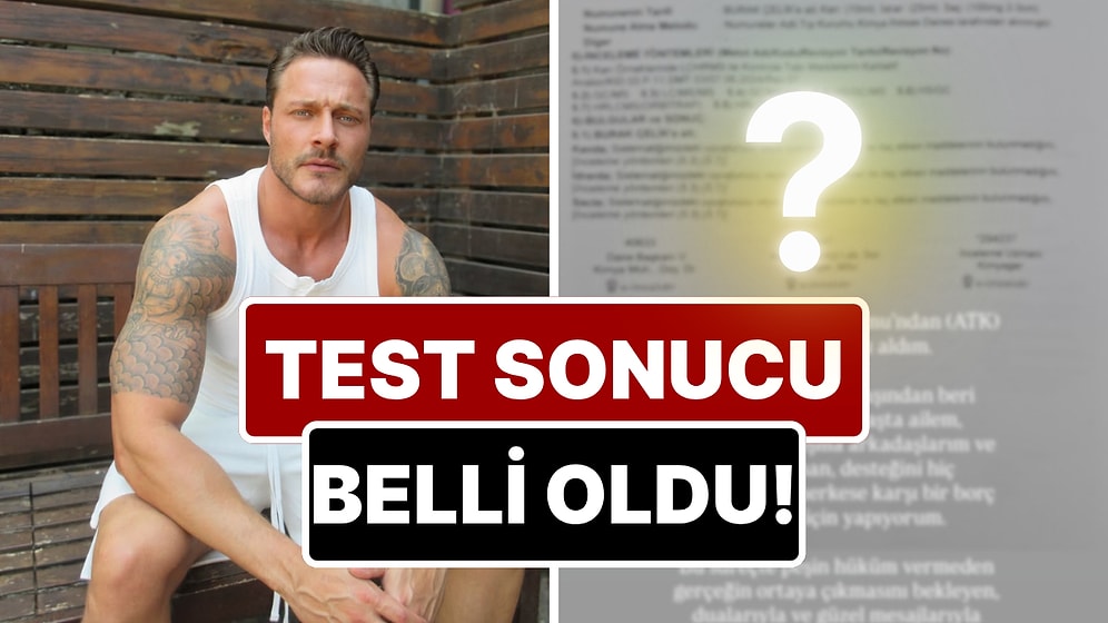 Gözaltına Alınan Burak Çelik'in Yasaklı Madde Test Sonucu Belli Oldu!
