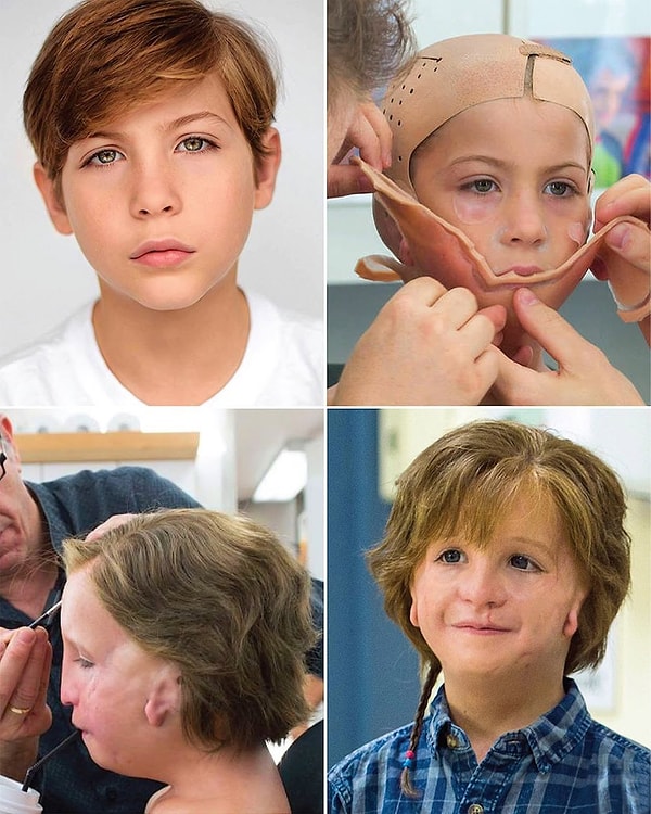 Many people who watched 'Wonder' believed that Jacob Tremblay's face was actually like that in real life.