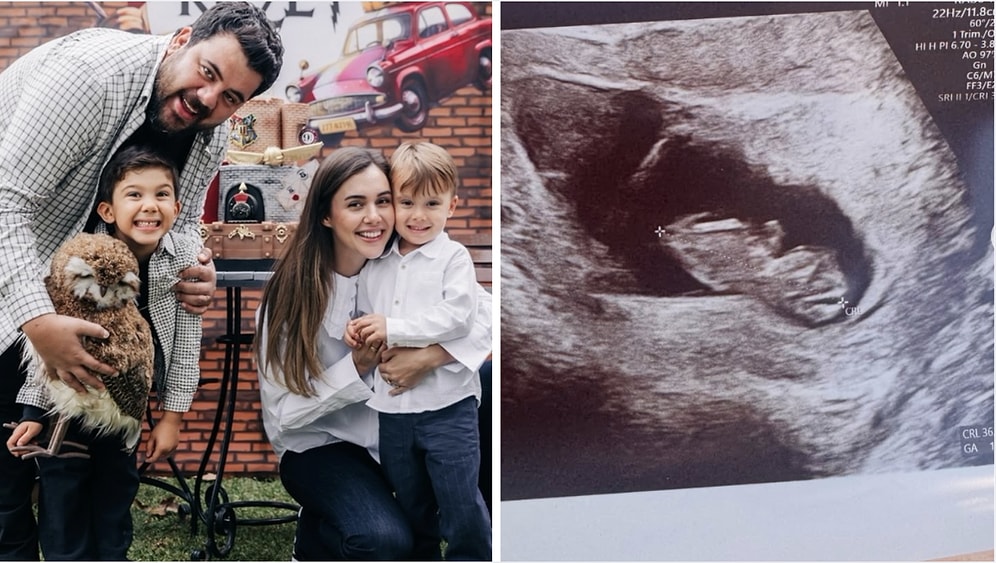 Berfu Yenenler Shares Heartbreaking Statement After Losing Her Baby at 12 Weeks