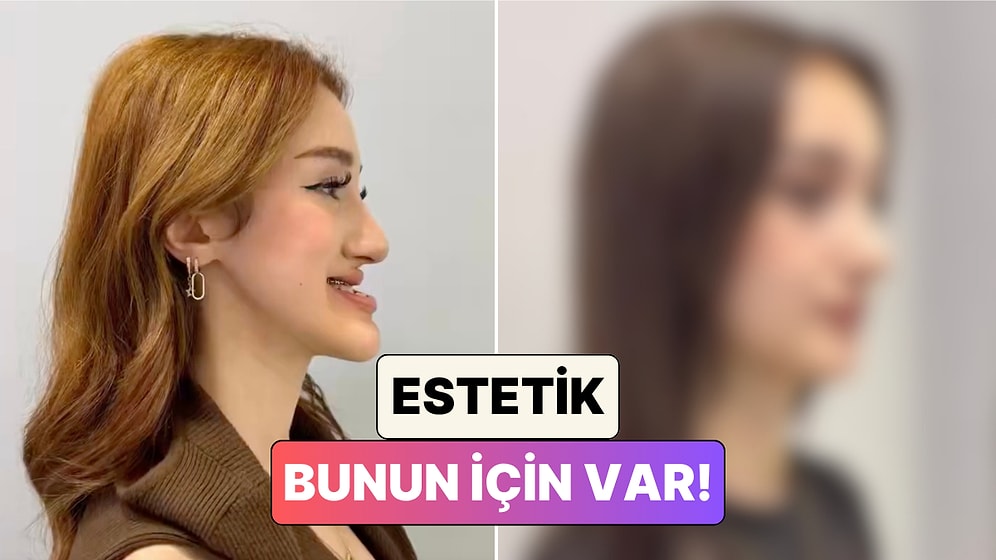 Çene Ameliyatı Geçiren Bir Kadının Yaşadığı Değişim Beğeni Topladı