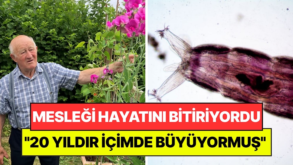 Yıllardır Yaptığı Çiftçilik Hayatına Mal Oluyordu: "20 Yıldır Vücudumda Sessizce Büyüyormuş"