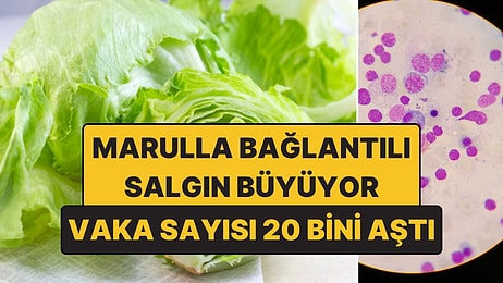 Marulla Bağlantılı Cyclospora Salgını Büyüyor: Vaka Sayısı 20 Bini Aştı