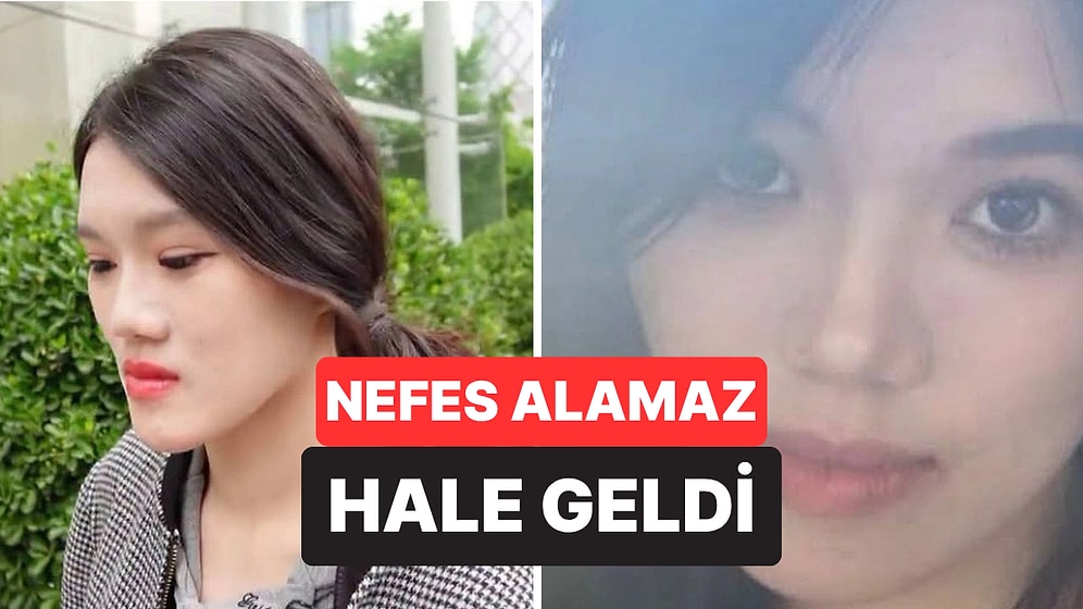 Çene Estetiği Kabusa Döndü: Yanlış Ameliyat Sonrası Yüzü Tanınmaz Hale Geldi