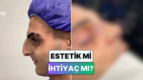 4 Kere Burnu Kırılan Dövüş Sporcusu Hastanın Burun Ameliyatı Sonrası İnanılmaz Değişimi