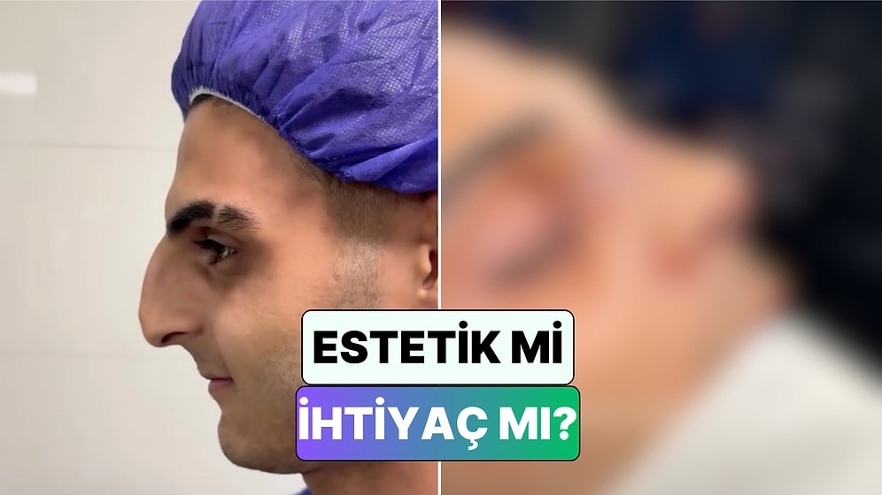 4 Kere Burnu Kırılan Dövüş Sporcusu Hastanın Burun Ameliyatı Sonrası İnanılmaz Değişimi