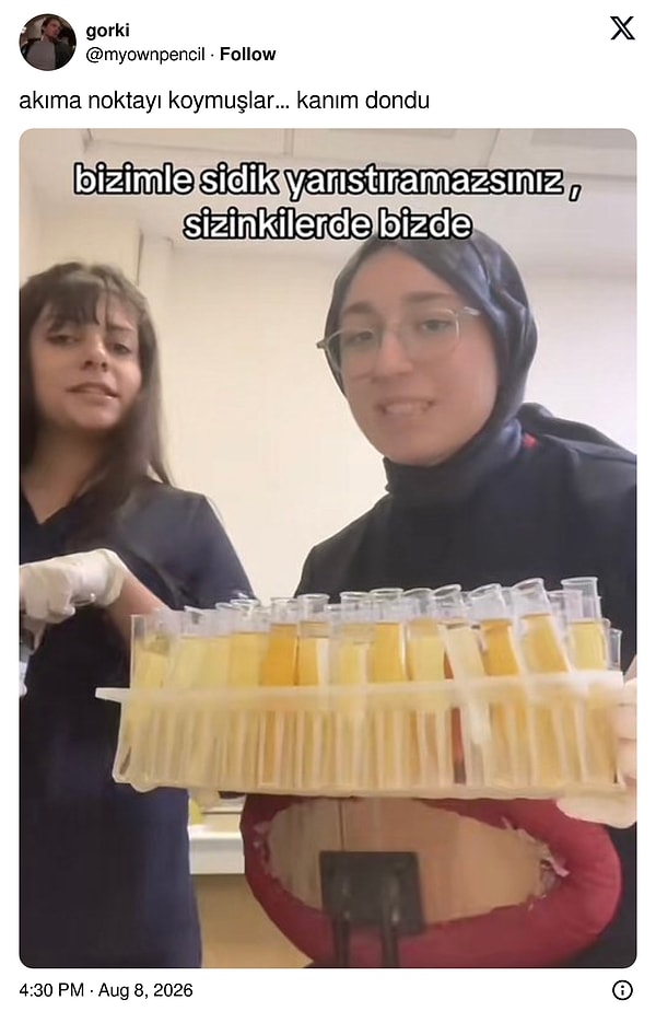 Bir süre ekrana bakacaksınız maalesef.