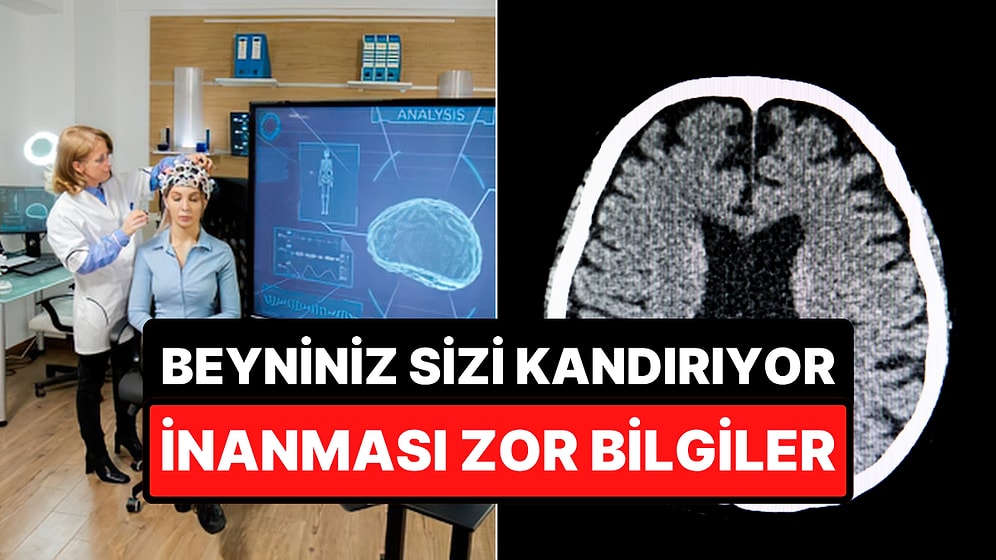 Bilime Göre Beyniniz Hakkında İnanmakta Zorlanacağınız Bilgiler