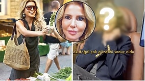 Gülben Ergen Reveals Her New Look After Undergoing Full-Face Rejuvenation