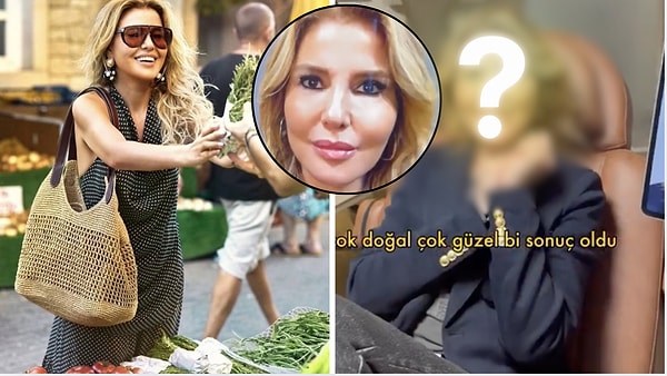 Gülben Ergen Reveals Her New Look After Undergoing Full-Face Rejuvenation