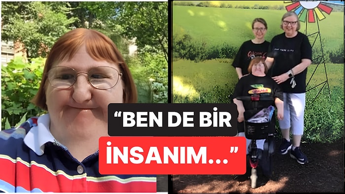 Kendisine “Çirkin” Diyen Trolleri Böyle Susturdu: Bir Yıl Boyunca Peş Peşe Selfie Paylaştı
