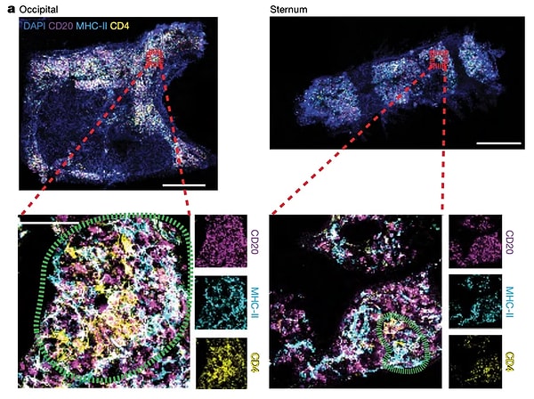 İnsan anatomisinin yüzyıllar süren tıbbi çalışmalarla tamamen çözüldüğü düşünülse de, tıp dünyası vücudumuzun bilinmeyen sırlarını gün yüzüne çıkarmaya devam ediyor.