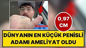 Yardım Kampanyası Başlatılmıştı: Dünyanın En Küçük Penisli Adamı (0,97 cm) Büyütme Ameliyatı Oldu