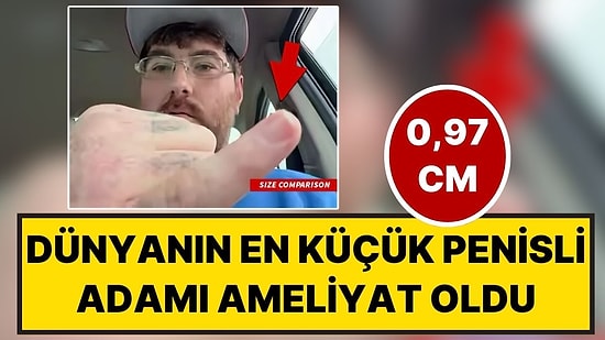 Yardım Kampanyası Başlatılmıştı: Dünyanın En Küçük Penisli Adamı (0,97 cm) Büyütme Ameliyatı Oldu