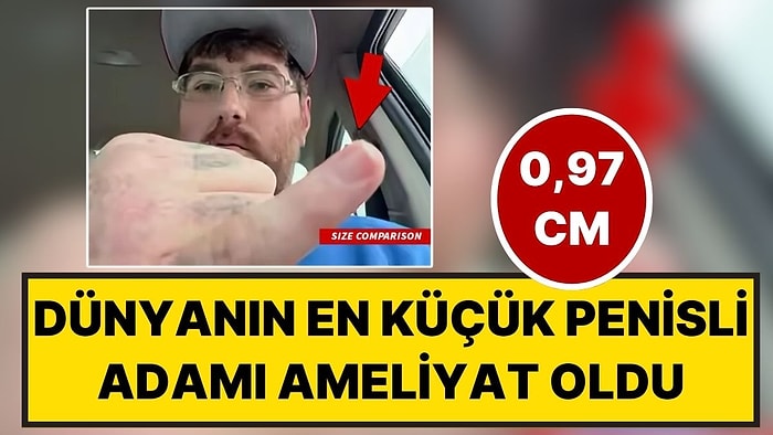 Yardım Kampanyası Başlatılmıştı: Dünyanın En Küçük Penisli Adamı (0,97 cm) Büyütme Ameliyatı Oldu