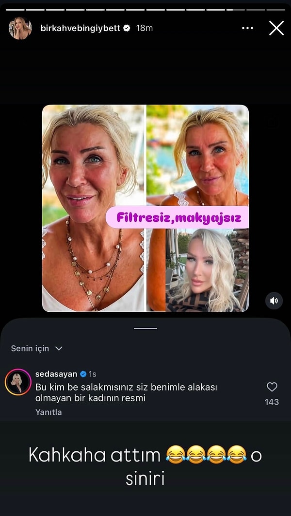 "Filtresiz, makyajsız Seda Sayan" diye paylaşıldı, Seda Sayan fotoğrafı görünce fena çıkıştı!