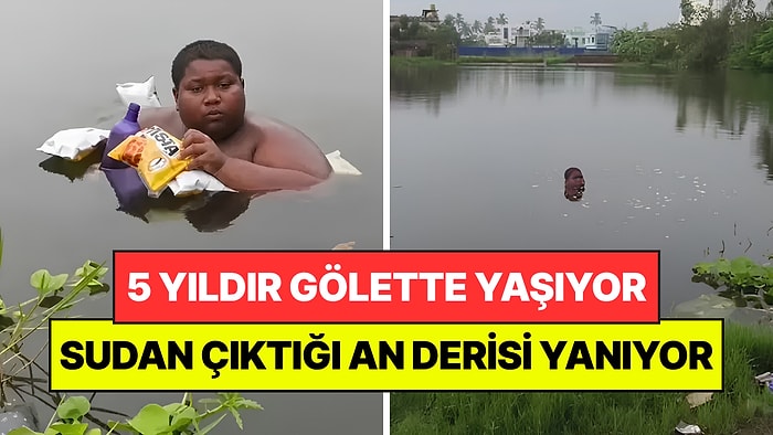 16 Yaşındaki Genç 5 Yıldır Gölette Yaşıyor: Hastalığı Yüzünden Sudan Çıkamıyor