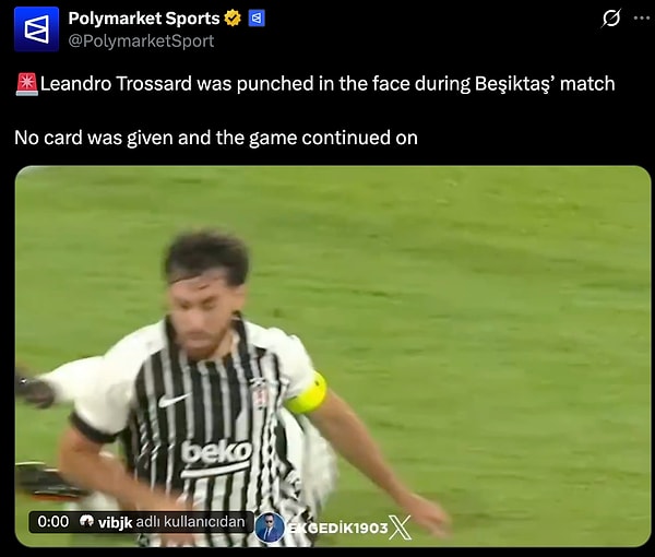 "Beşiktaş maçında Leandro Trossard'ın yüzüne yumruk atıldı. Olayda kart gösterilmedi ve maç devam etti."