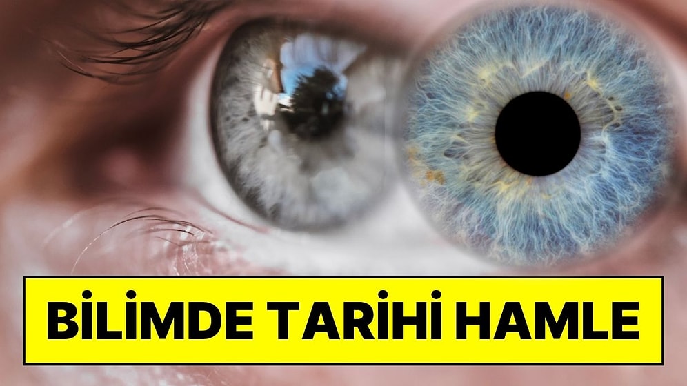 Bilim Dünyasında Bir İlk Gerçekleşti: Görme Kaybına Karşı Bacaktan Göze 'Hücresel Pil' Nakli