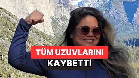 Rutin Kontrolde Ortaya Çıktı: 41 Yaşındaki Kadın Tüm Uzuvlarını Kaybetti