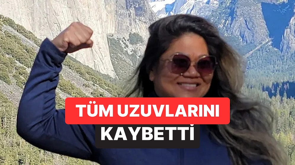 Rutin Kontrolde Ortaya Çıktı: 41 Yaşındaki Kadın Tüm Uzuvlarını Kaybetti