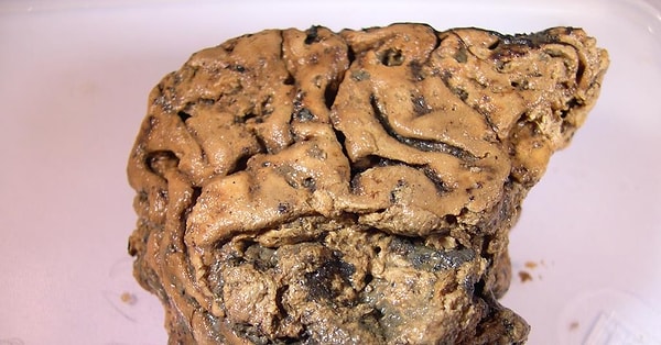 Çürümeyi başlatan tepkimeler dokuyu sağlamlaştırdı
