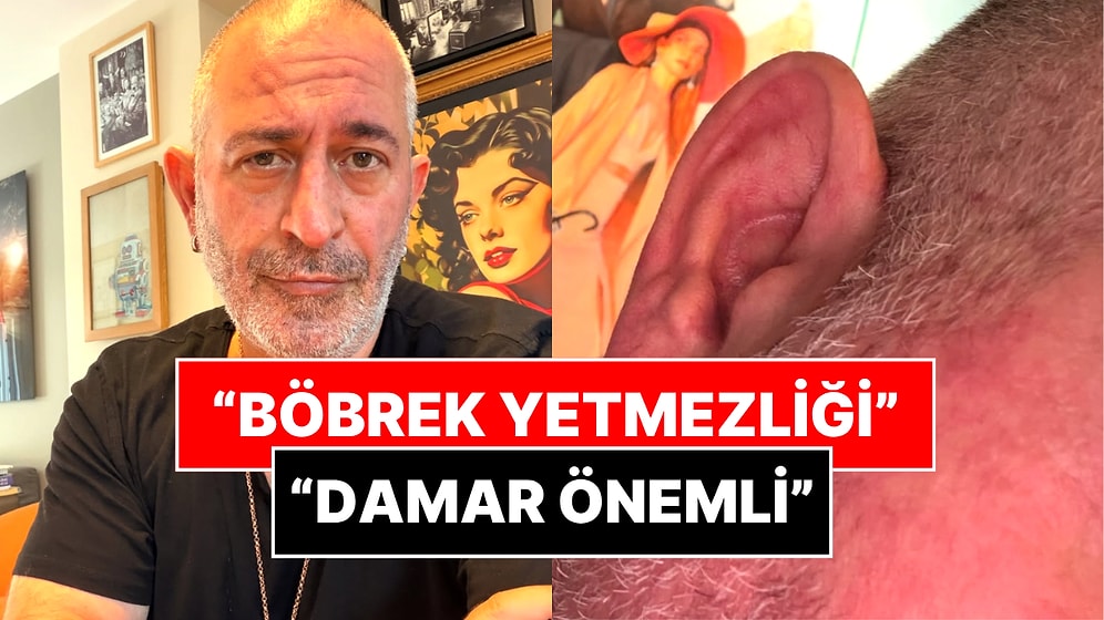 Son Halini Paylaştı: Cem Yılmaz'dan "Kulak Çizgisi Kalp Krizi Habercisi" Goygoyu