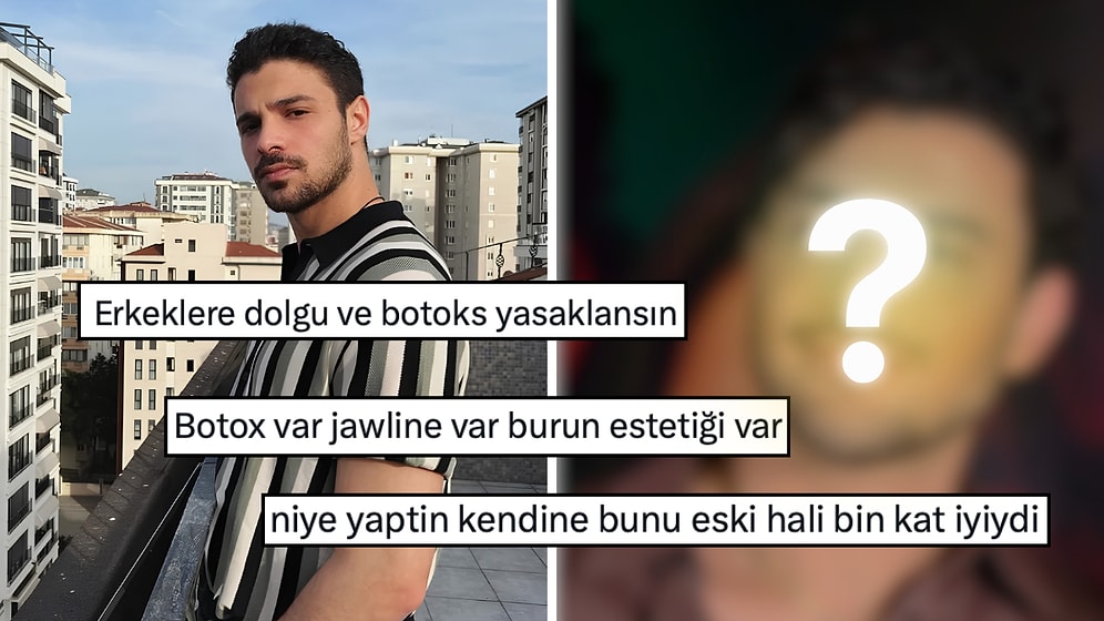 Oyuncu Halit Özgür Sarı’nın Son Hali Dolgu ve Botoks İddialarını Alevlendirdi!