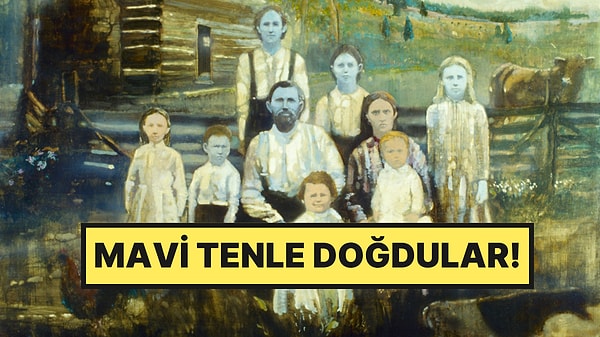 Mavi Tenle Doğan Ailenin 140 Yıllık Sırrı Sonunda Çözüldü