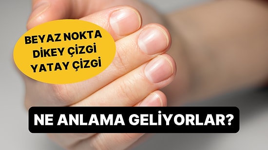 Tırnaktaki Beyaz Noktalar Kalsiyum Eksikliği Değil: Dermatolog Asıl Sebebi Açıkladı