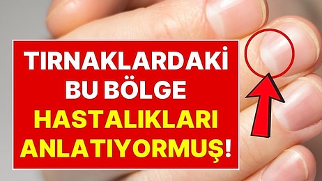 Tırnağınızın Rengi Kırmızı, Mavi ya da Kahverengiye mi Dönüyor? Her Biri Farklı Bir Hastalığa İşaret Ediyor