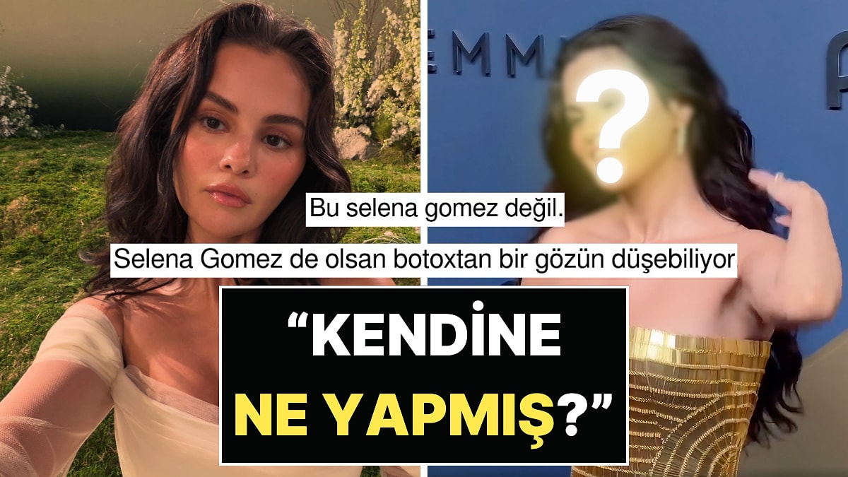 Emmy Kırmızı Halısında Boy Gösteren Selena Gomez'in Yüzünün Son Hali Şoke Etti: "Kendine Ne Yaptın?"