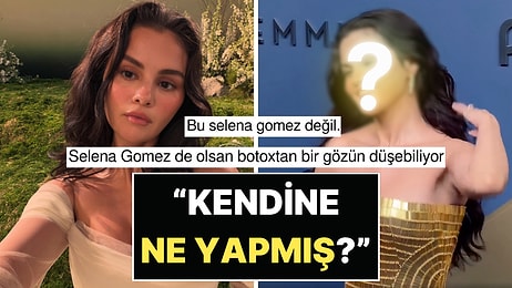 Emmy Kırmızı Halısında Boy Gösteren Selena Gomez'in Yüzünün Son Hali Şoke Etti: "Kendine Ne Yaptın?"