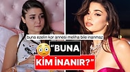 "Yüzümde Botoks da Estetik de Yok" Diyen Hande Erçel'e Eski Hali Hatırlatıldı!