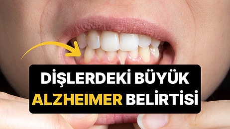 Diş Fırçalarken Kanama Görüyorsanız Dikkat: 1.396 Kişilik Araştırmadan Alzheimer Uyarısı