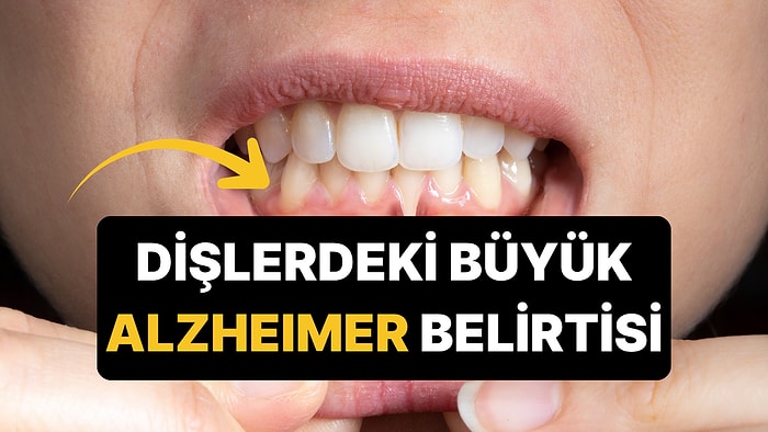 Diş Fırçalarken Kanama Görüyorsanız Dikkat: 1.396 Kişilik Araştırmadan Alzheimer Uyarısı
