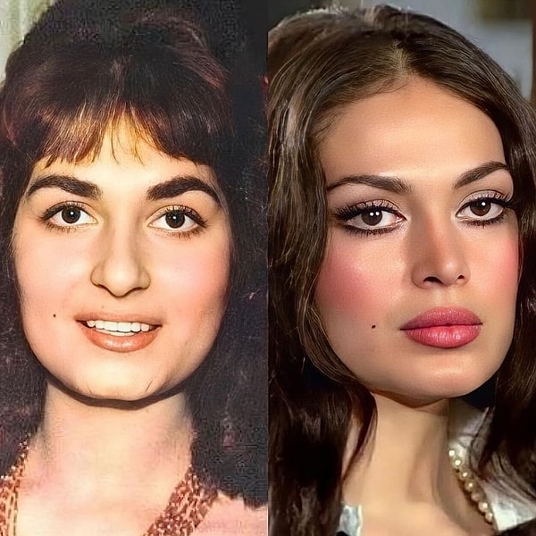 Yeşilçam'ın "Sultan"ı Türkan Şoray'ın güzelliğini anlatmaya kalksak herhalde sabaha kadar buradayız! Fakat yıllardır hayran olduğumuz o görünümün arkasında yalnızca genetik yoktu.