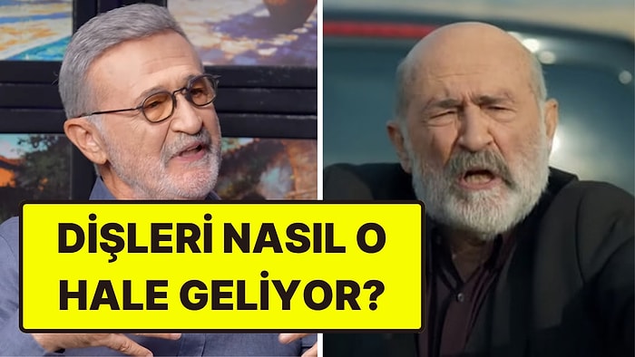 Uzak Şehir'in Ecmel'i Müfit Kayacan'ın Sapsarı Dişlerinin Sırrı Ortaya Çıktı