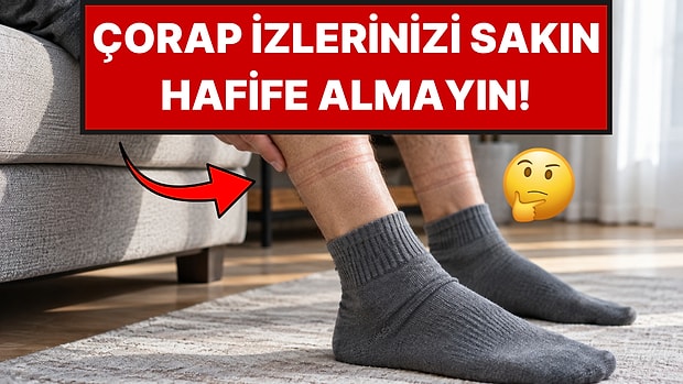 Her Çorap İzi Masum Değil: Çoraplarınız Bacağınızda İz Bırakıyorsa Neye İşaret Ediyor?
