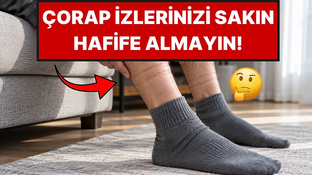 Her Çorap İzi Masum Değil: Çoraplarınız Bacağınızda İz Bırakıyorsa Neye İşaret Ediyor?
