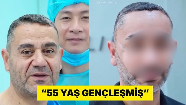 Vietnam'da Estetik Yaptıran 58 Yaşındaki Türk Vatandaşın Değişimi Viral Oldu